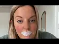 Doctors Warn About Risks of TikTok Mouth Taping Trend