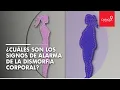 Como saber si sufro de dismorfia corporal Caracol Radio
