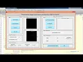 Mammogram Image Compression using SPIHT Fractal MATLAB source code