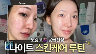 "피부과 다니죠?" 소리 듣는 홈케어 나이트 루틴 전부 공개🔥 | 앰플 효과 2배 보는 순서 | 아랑