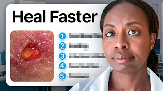 The 5 Hidden Reasons Why Your Wounds Won t Heal