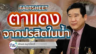 ควรทำอย่างไรเมื่อมีอาการตาแดงที่สงสัยว่าเกิดจากน้ำปนเปื้อน