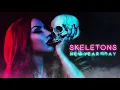 New Years Day - Skeletons (Audio)