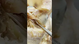 Look At The REAL Human Eye Shorts Eyes 