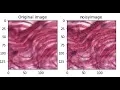 Top Data Augmentation Techniques for Computer Vision