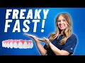 Can You Really Get Dental Implants in 24 Hours