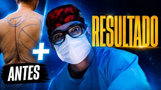 O QUE ACONTECE EM UM DIA DE CIRURGIA? Mastopexia + Lipo HD + Glúteo