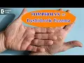 DYSHIDROTIC ECZEMA OR POMPHOLYX Causes Symptoms Treatment - Dr Aruna Prasad Doctors Circle