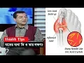 What is arthritis pain and its symptoms? | Health Tips | Gout Pain | Somoy TV