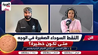 النقط السوداء الصغيرة في الوجه، متى تكون خطيرة ❌