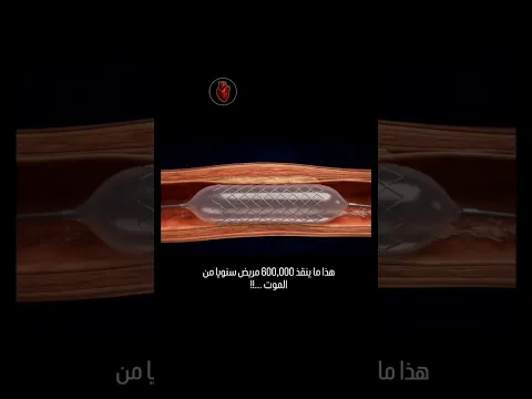 ﴿ وَإِذَا مَسَّ الْإِنسَانَ ضُرٌّ دَعَا رَبَّهُ مُنِيبًا إِلَيْهِ ﴾