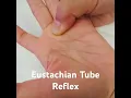 Eustachian Tube Reflex