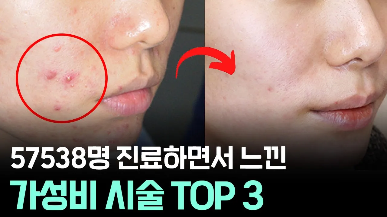 청담동에서 5만 명 피부시술 하며 느낀 가성비 TOP 3