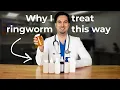 Ringworm Isn t Just a Rash How I Treat It in Practice