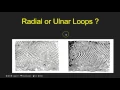 Classifying Loops Two