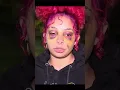 Download Lagu BATTERED \u0026 BRUISED DOMESTIC VIOLENCE SURVIVOR WARNS OTHERS