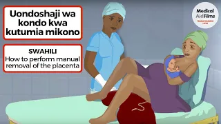 uondoshaji wa kondo kwa kutumia mikono