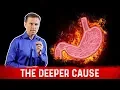Download Lagu The Real Causes of Acid Reflux, Heartburn \u0026 GERD – Dr.Berg