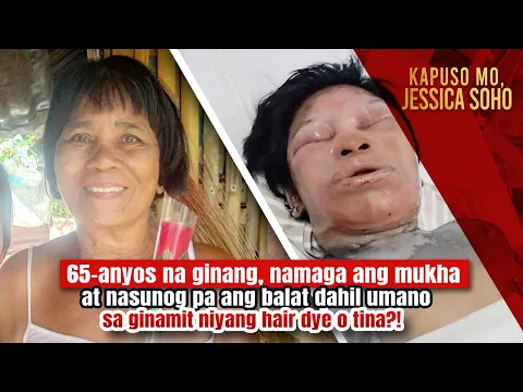 Download MP3 Ginang, nasunog ang balat dahil umano sa ginamit niyang hair dye o tina?! | Kapuso Mo, Jessica Soho