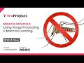 Malaria Detection Using Image Processing and Machine Learning btech mtech mini major ieee projects