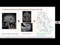 Multiple Sclerosis Lecture Series Novel Therapies