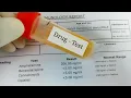 Will Suboxone Show Up on a Drug Test