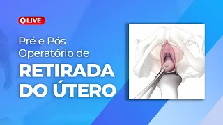 Cuidados antes e depois da histerectomia - Pré e pós operatório de retirada do útero
