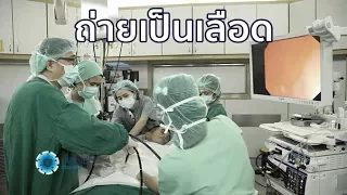 เลือดออกทางทวารหนักปริมาณมากและถ่ายติดกันหลายครั้ง อาจบ่งบอกถึงโรคอะไรได้บ้าง