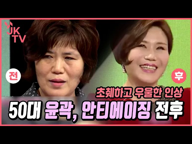 💐중년성형💐 50-60대 윤곽, 지방이식, 풀페이스리프팅 👧