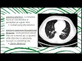 General Psychology Chapter 4 Consciousness
