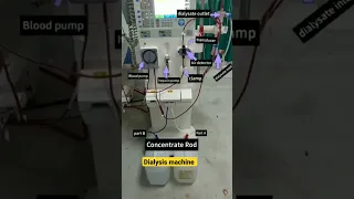 Dialysis machine