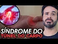 Lagu SÍNDROME DO TÚNEL DO CARPO DESSE JEITO VOCÊ VAI ENTENDER