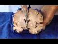 The Visual Pathway Neuroanatomy Lab - Brain Dissections ARCHIVE