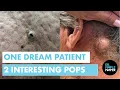 A Dream Patient Dr Pimple Popper Takes on Two Interesting Pops