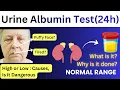 Urine Protein Test 24 hours Urine Albumin Test Microalbumin Test for Urine