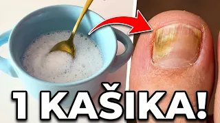 Bacite tablete! Ovo 100% Uklanja Gljivice na Noktima Nogu..