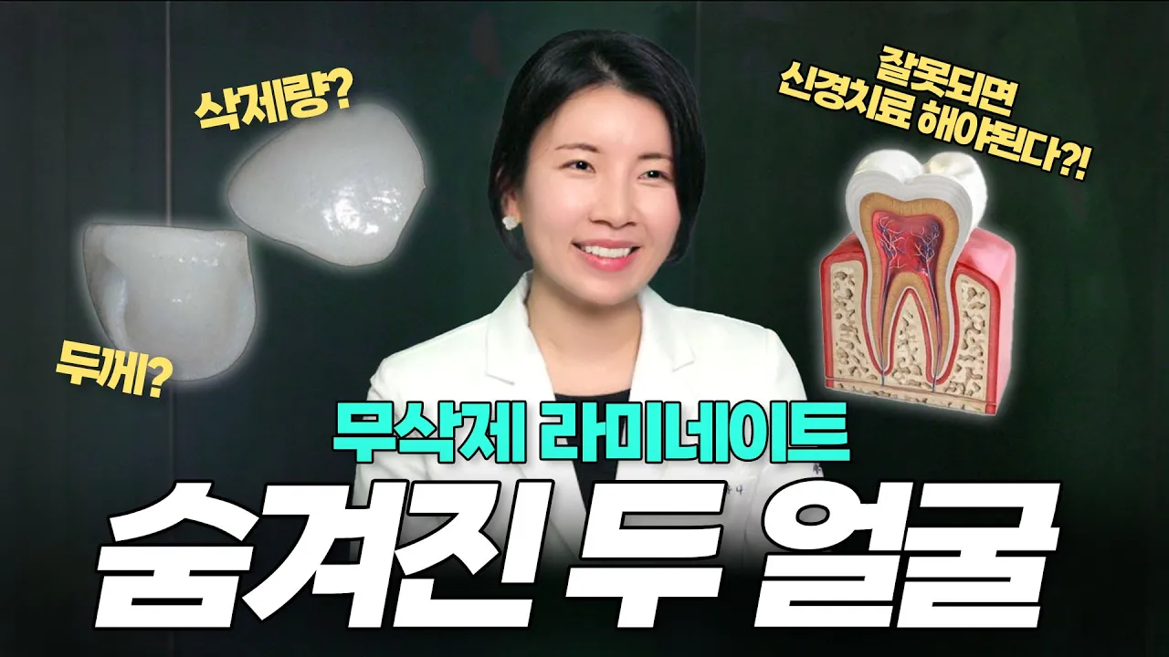 무삭제 라미네이트 낱낱이 파헤치기(팩폭주의)