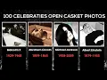 Graphic 100 Celebrity Open Casket Photos 2024 VIEWER DISCRETION ADVISED