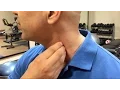 How to treat scalene muscle trigger points - trigger points