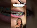 What Your Rubber Bands Do