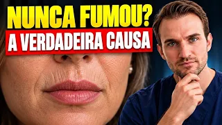 Rugas ao Redor da Boca Sem Fumar? Entenda a Causa