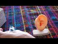 Download Lagu Step by step gentle technique practice session: needling the NADA protocol tube \u0026  plastic ear