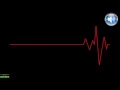 Download Lagu Heartbeat Sound Effect Slow To Fast I Heartbeat Speeding Up Sound Effect #1