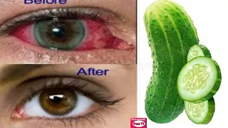 Download FORGET YOUR EYEGLASS WITH THIS SUPER EYE TREATMENT - Improve Eyesight Naturally with cucumber MP3