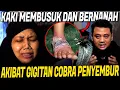 Download Lagu KAKI TERANCAM DIAMPUT*SI !! NOLONG KORBAN GIGITAN ULAR COBRA PENYEMBUR
