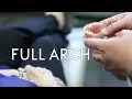 Dr Schimmele Discusses Common Questions about Full Arch Dental Implants