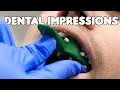 Dental Impressions Pouring Teeth Models