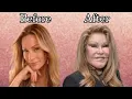 The Story Of JOSELYN WILDENSTEIN aka Cat woman Plastic Surgery Billionaire marriage and more