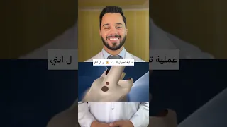 عملية تحويل الرجل لامرأة 