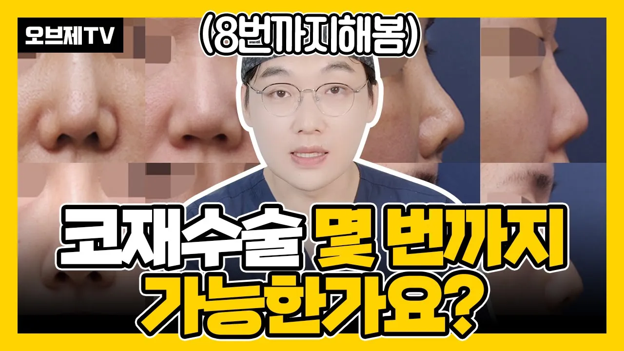 코재수술 몇 번까지 가능한가요? 다들 궁금한데 물어보기 어려웠잖아요! 이경묵 원장님께 질문 드려봤습니다! (코수술, 코재수술, 코성형)